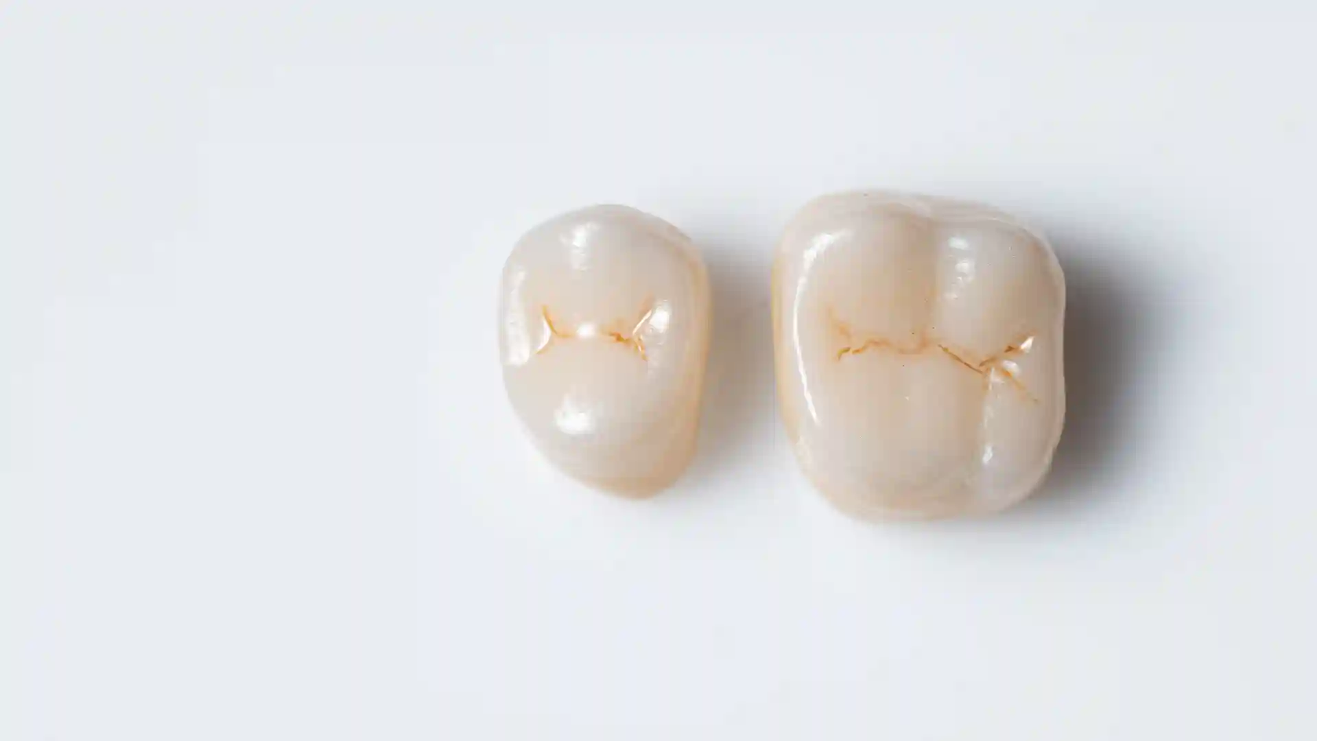 Dental Crown