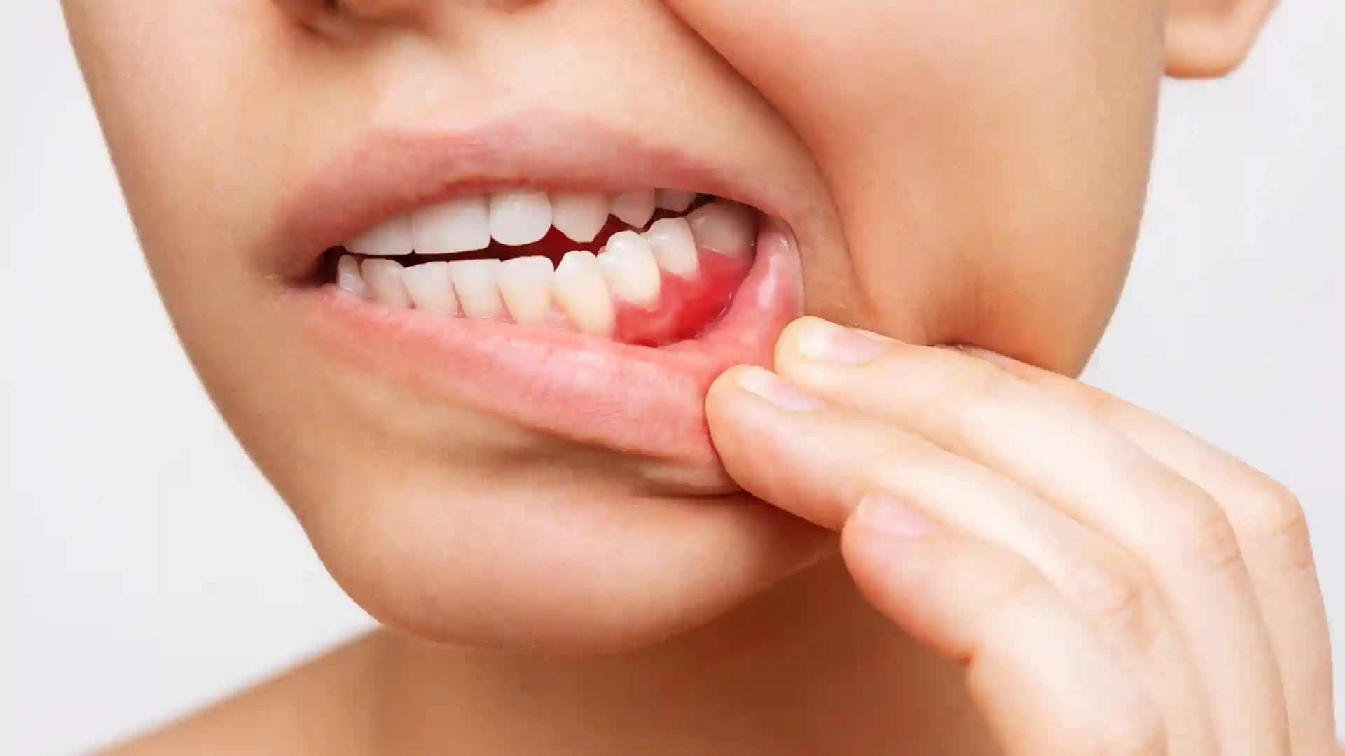 Periodontics